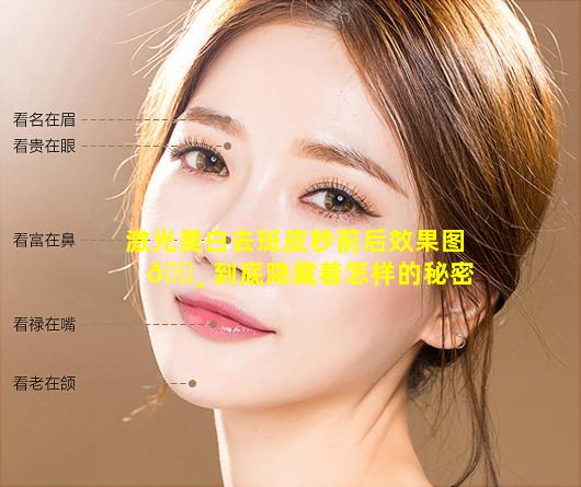 激光美白去斑皮秒前后效果图 🕸 到底隐藏着怎样的秘密